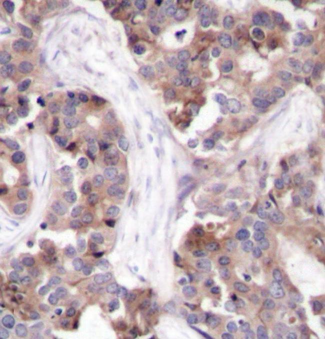 Phospho-Stathmin 1 (Ser25) Antibody in Immunohistochemistry (Paraffin) (IHC (P))