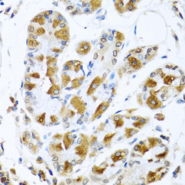 PIAS3 Antibody in Immunohistochemistry (Paraffin) (IHC (P))