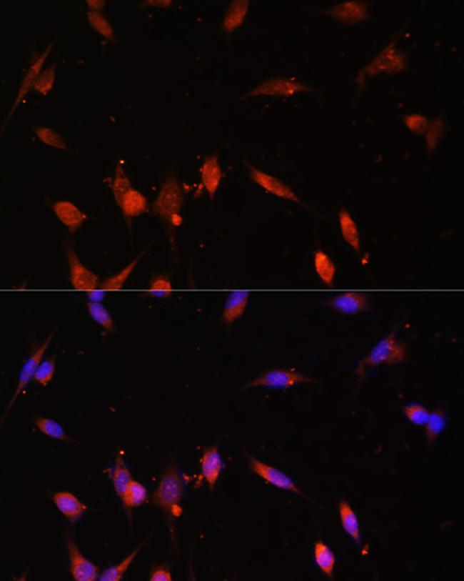 PI3K p55 gamma Antibody in Immunocytochemistry (ICC/IF)