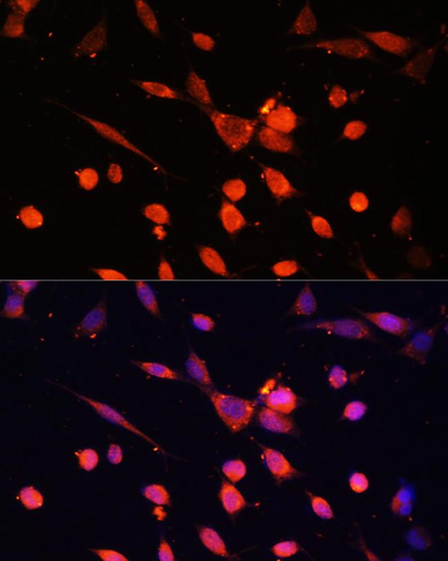 PI3K p55 gamma Antibody in Immunocytochemistry (ICC/IF)