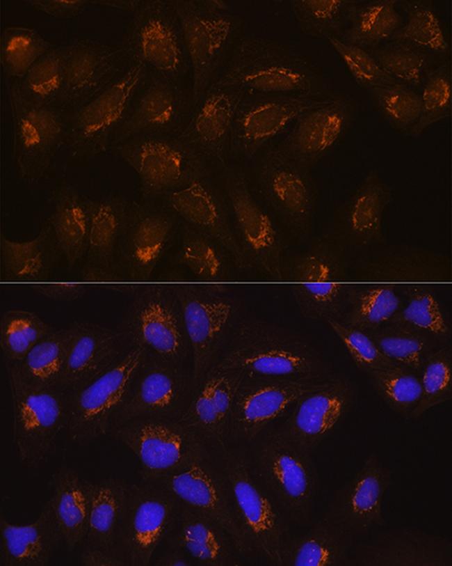 POFUT2 Antibody in Immunocytochemistry (ICC/IF)