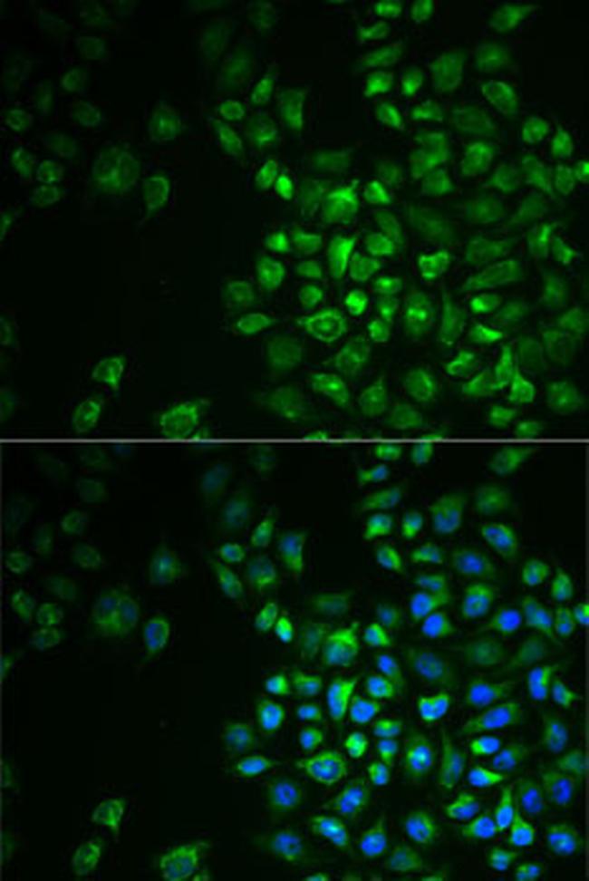 POLG2 Antibody in Immunocytochemistry (ICC/IF)