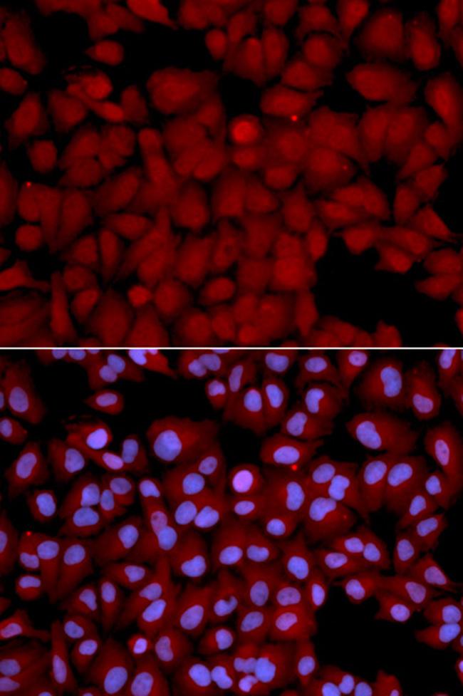 PPP1CB Antibody in Immunocytochemistry (ICC/IF)