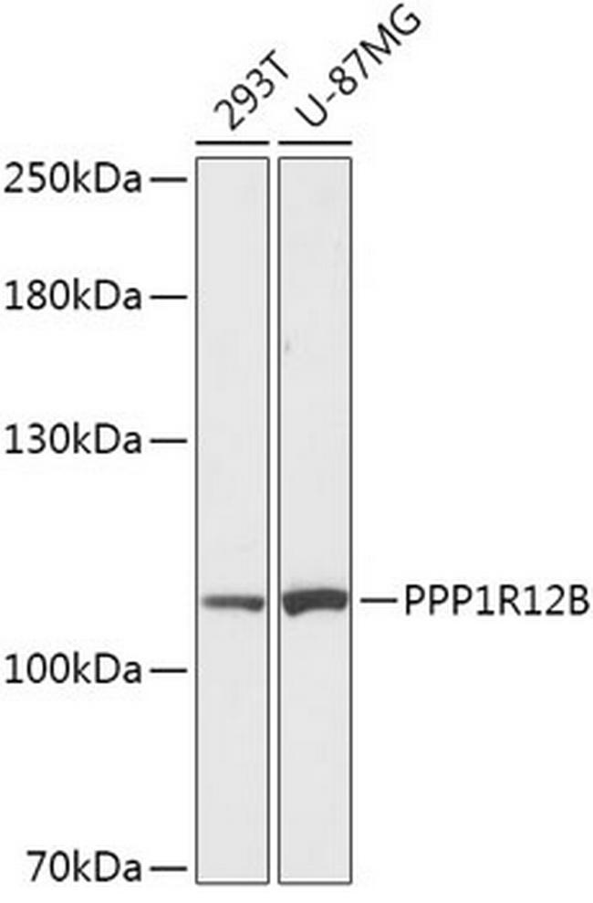 PPP1R12B Antibody in Western Blot (WB)