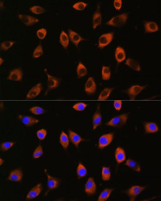 PPP1R9B Antibody in Immunocytochemistry (ICC/IF)