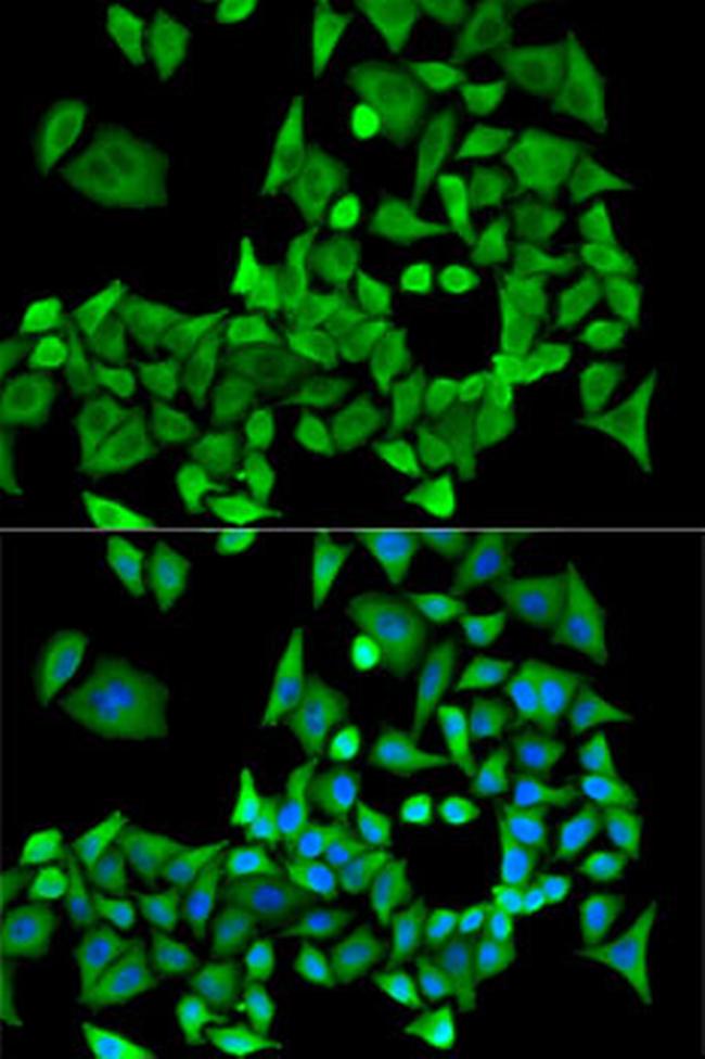 PPP2R1A Antibody in Immunocytochemistry (ICC/IF)