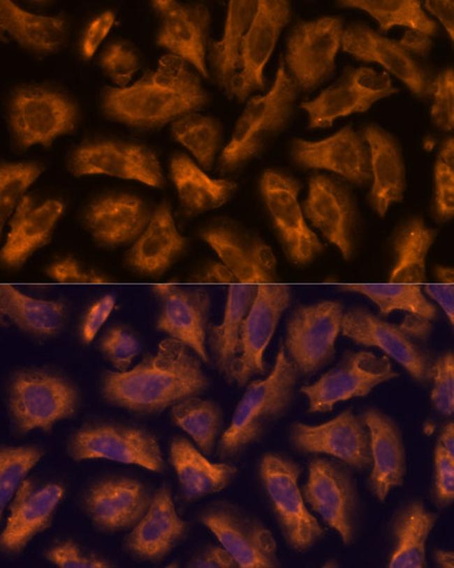 PTRF Antibody in Immunocytochemistry (ICC/IF)