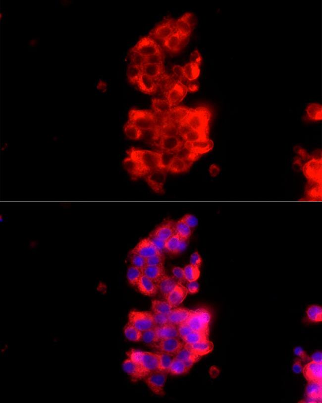 RAB27A Antibody in Immunocytochemistry (ICC/IF)