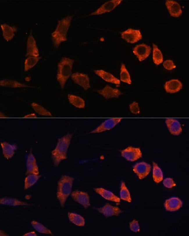 RAB5B Antibody in Immunocytochemistry (ICC/IF)