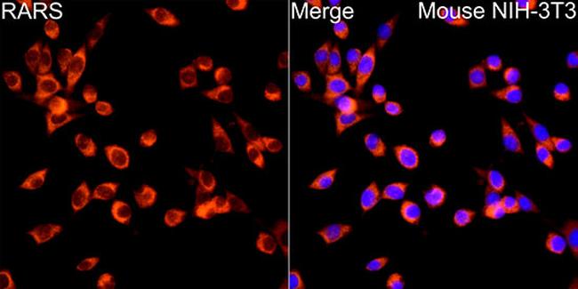 RARS Antibody in Immunocytochemistry (ICC/IF)