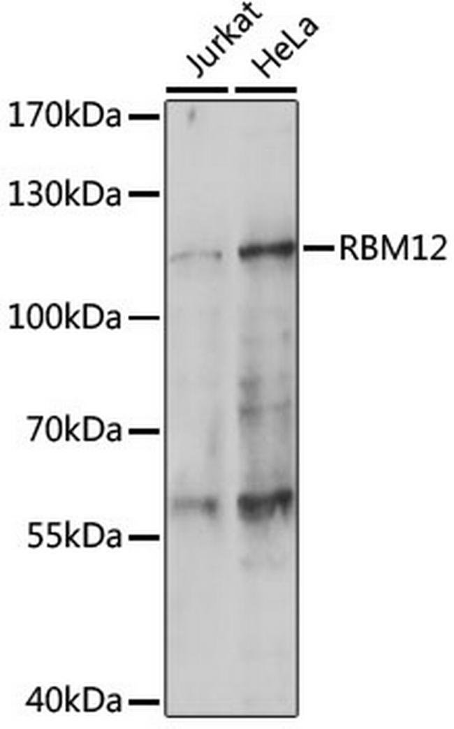 RBM12 Antibody in Western Blot (WB)