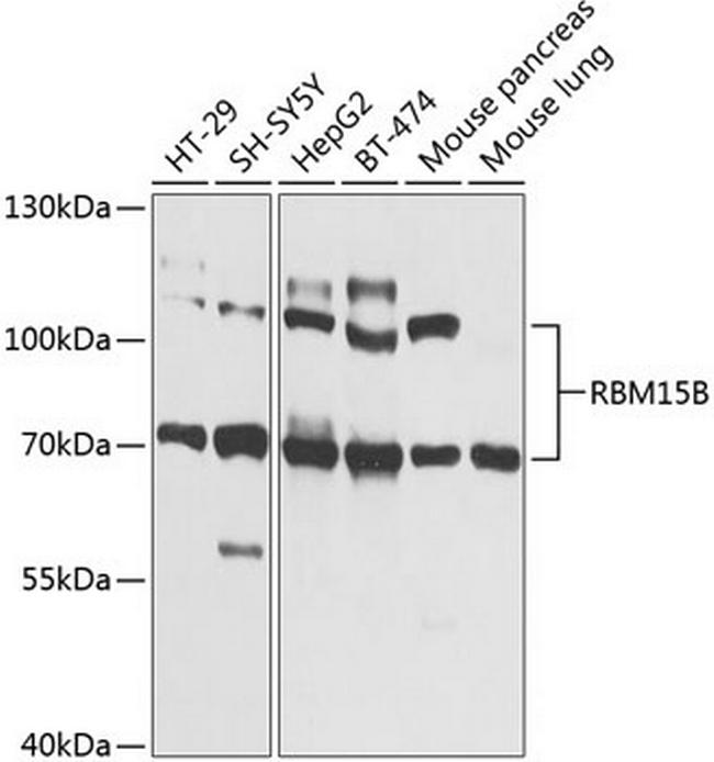 RBM15B Antibody in Western Blot (WB)