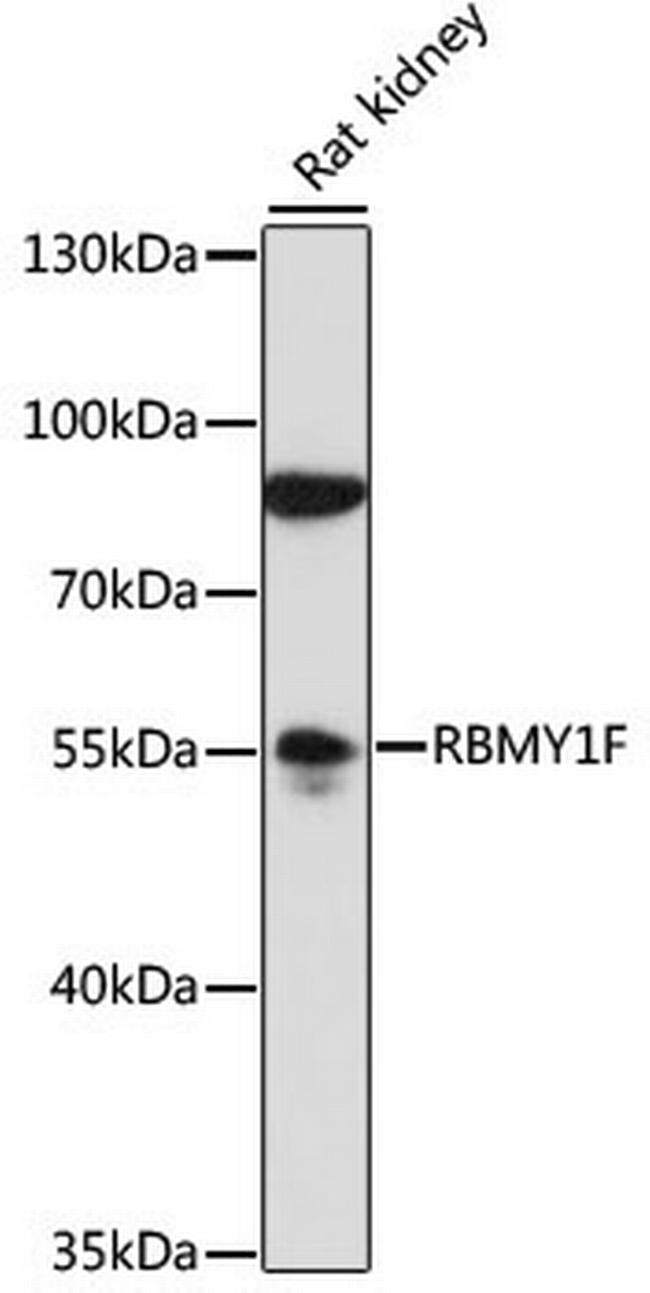 RBMY1F Antibody in Western Blot (WB)