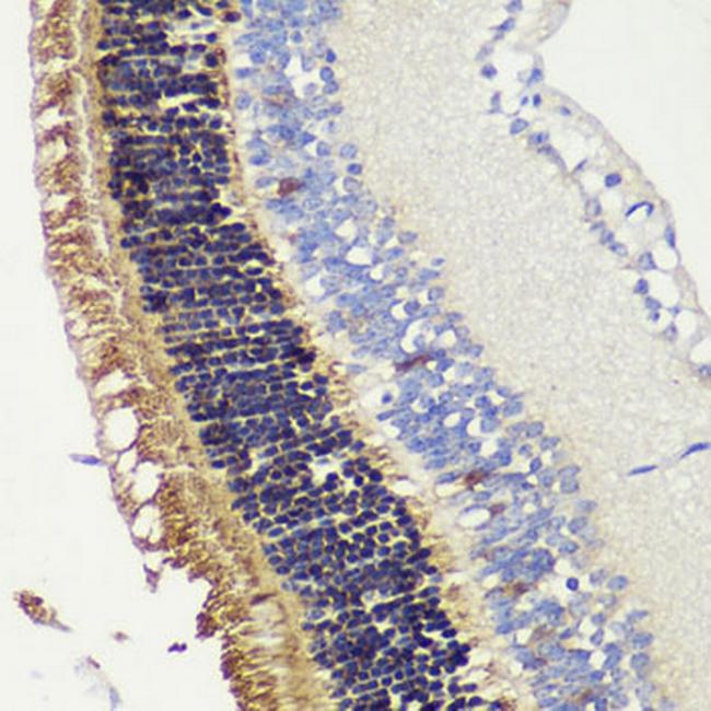 Recoverin Antibody in Immunohistochemistry (Paraffin) (IHC (P))