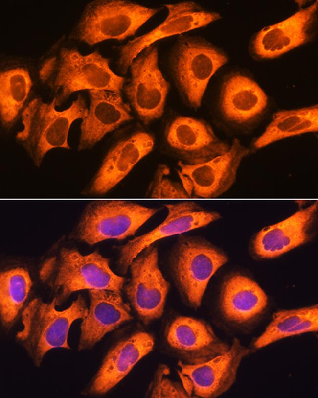 RIG-I Antibody in Immunocytochemistry (ICC/IF)