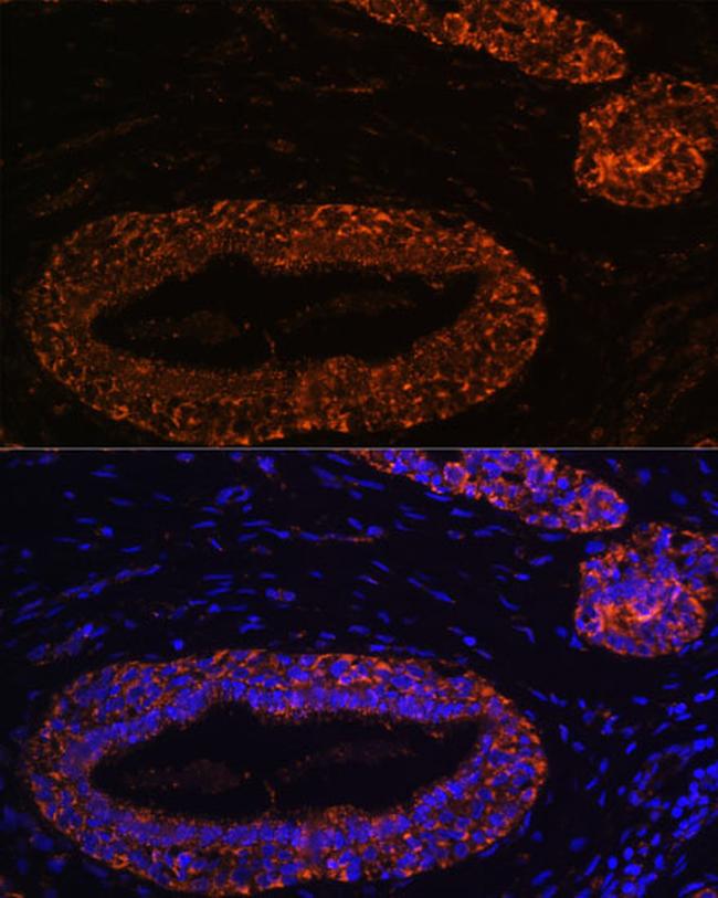 RNF31 Antibody in Immunohistochemistry (Paraffin) (IHC (P))