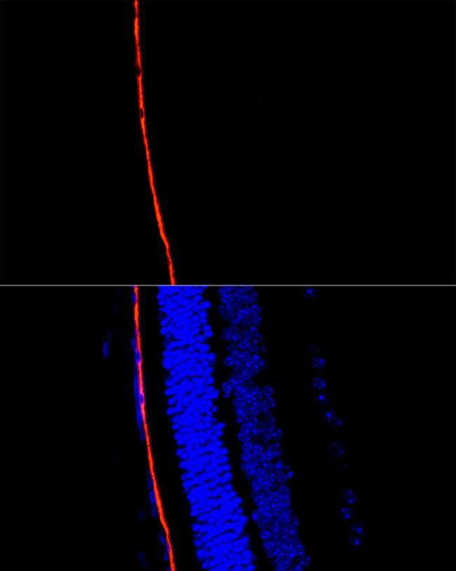 RPE65 Antibody in Immunocytochemistry (ICC/IF)