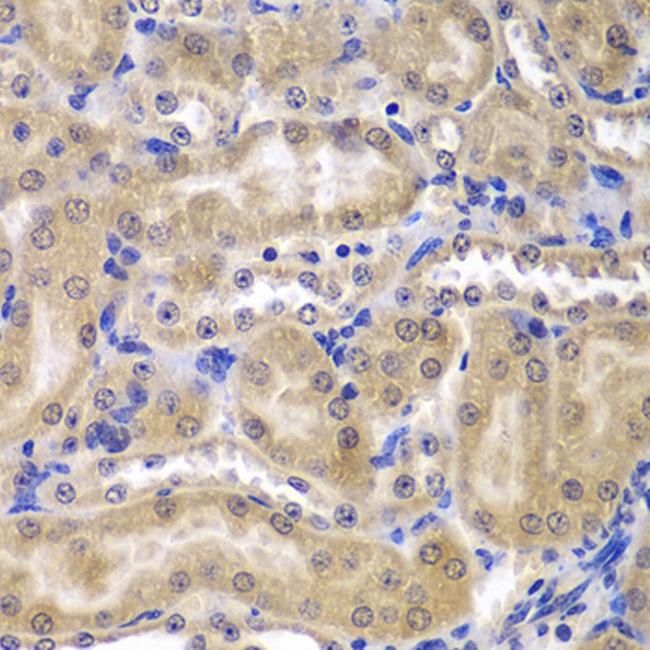 RPL5 Antibody in Immunohistochemistry (Paraffin) (IHC (P))