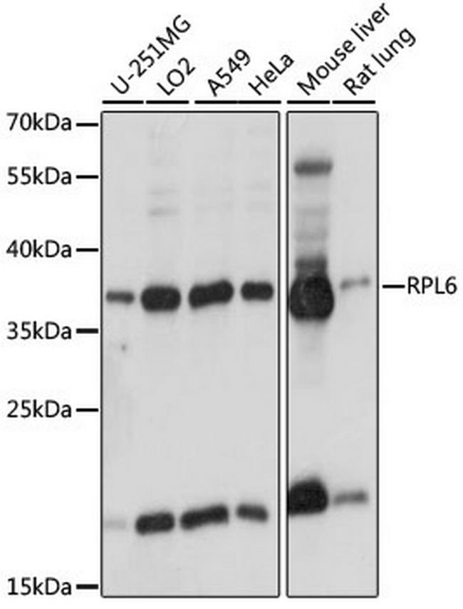 RPL6 Antibody in Western Blot (WB)