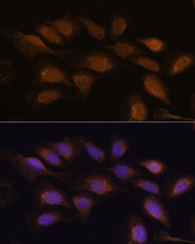 RSK3 Antibody in Immunocytochemistry (ICC/IF)