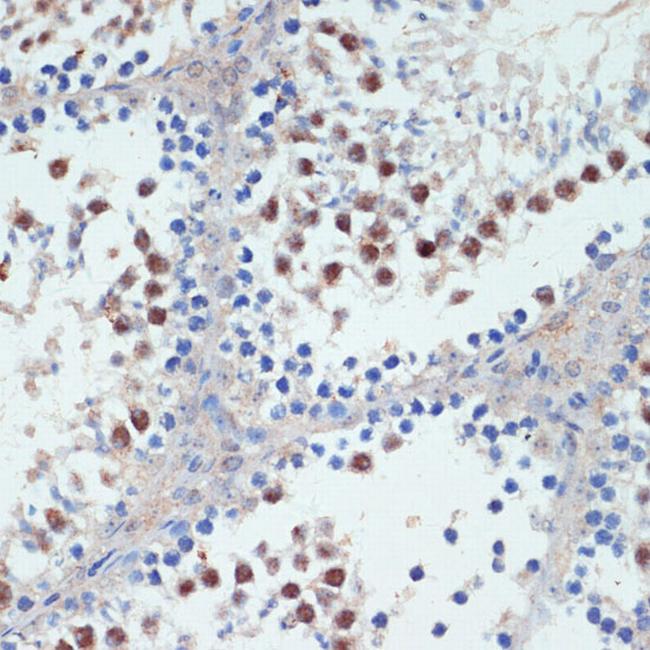 RXRG Antibody in Immunohistochemistry (Paraffin) (IHC (P))