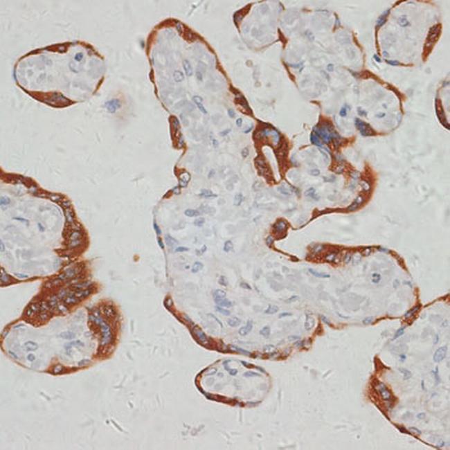 SARS2 Antibody in Immunohistochemistry (Paraffin) (IHC (P))