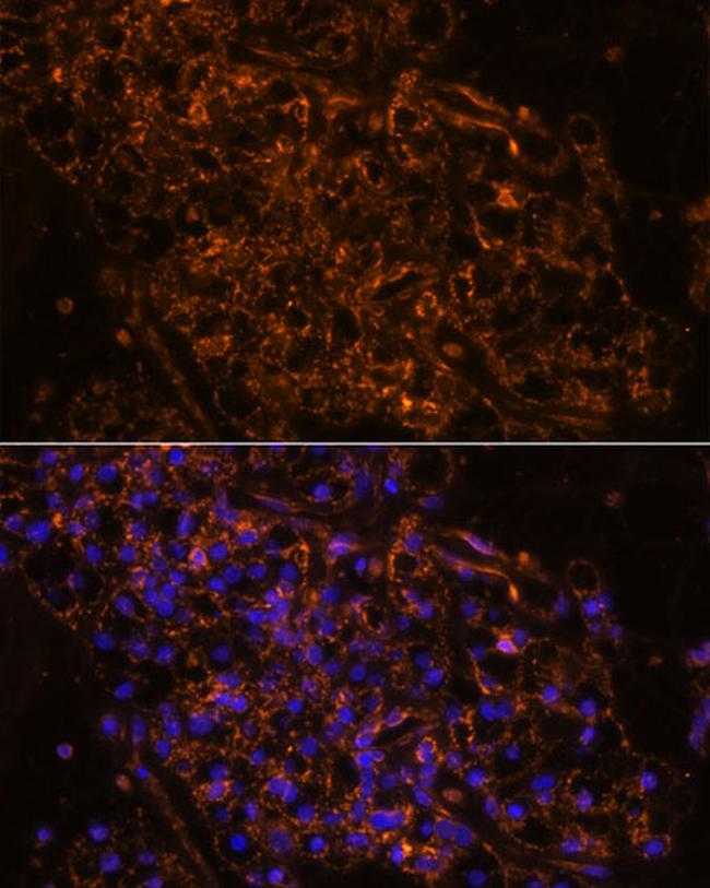 SCNN1G Antibody in Immunohistochemistry (Paraffin) (IHC (P))