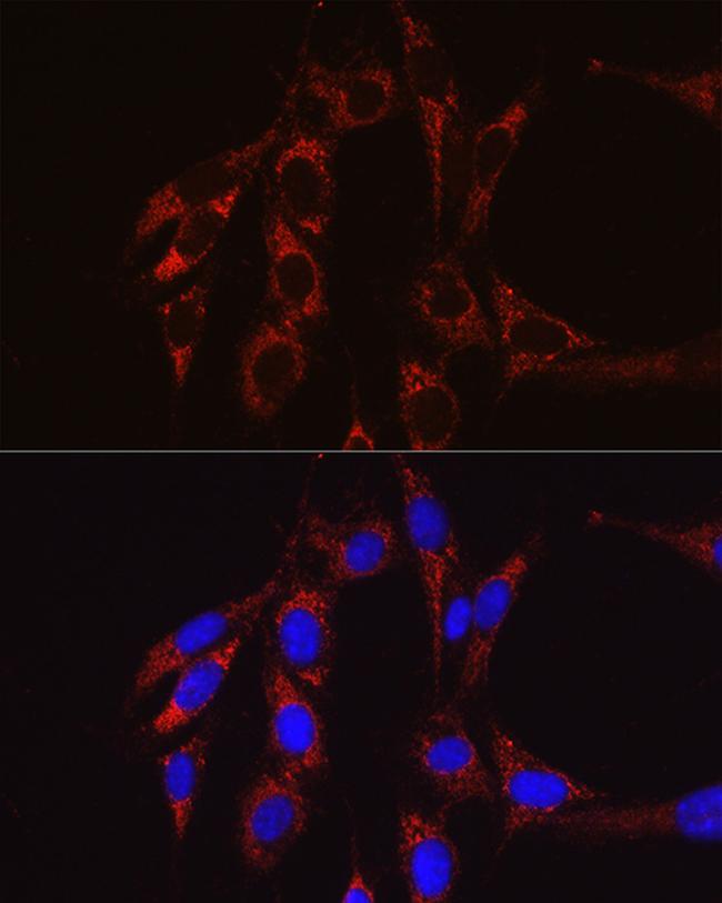 SBP2 Antibody in Immunocytochemistry (ICC/IF)