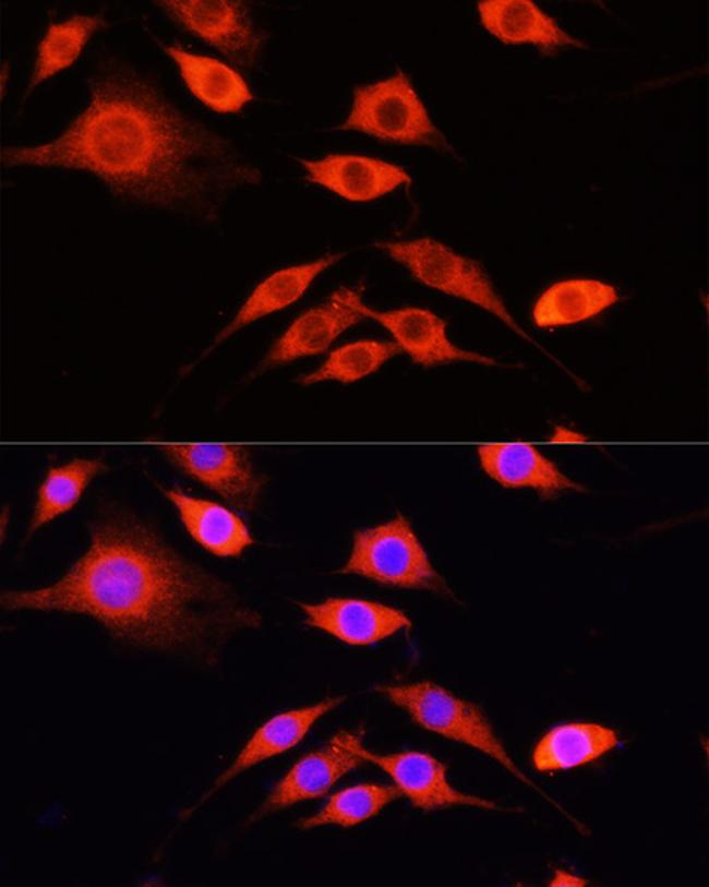 SERPINA10 Antibody in Immunocytochemistry (ICC/IF)