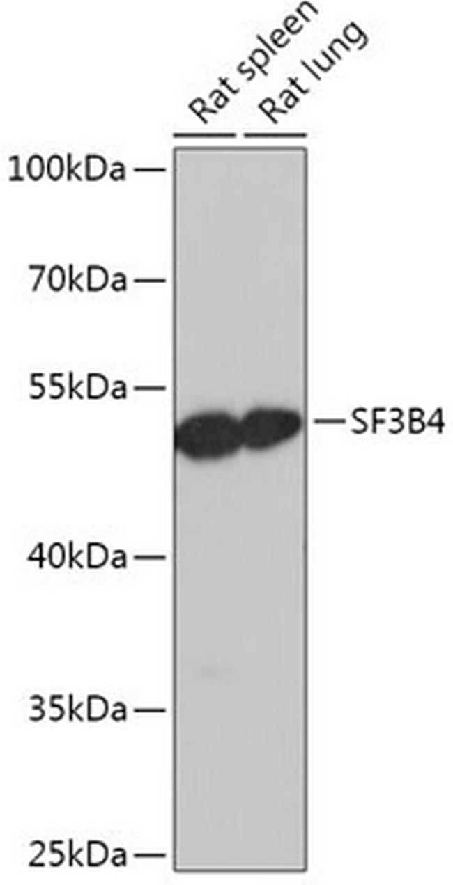 SF3B4 Antibody in Western Blot (WB)