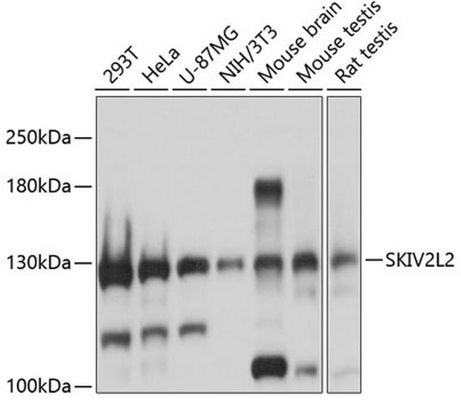 SKIV2L2 Antibody in Western Blot (WB)