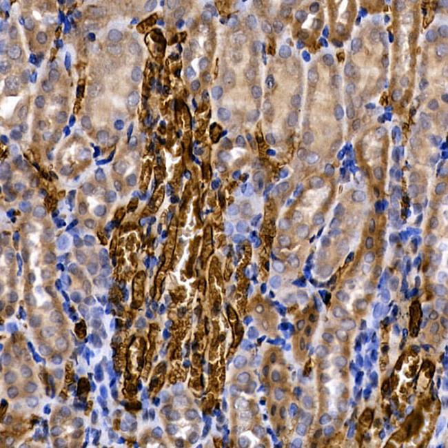 SLC14A1 Antibody in Immunohistochemistry (Paraffin) (IHC (P))