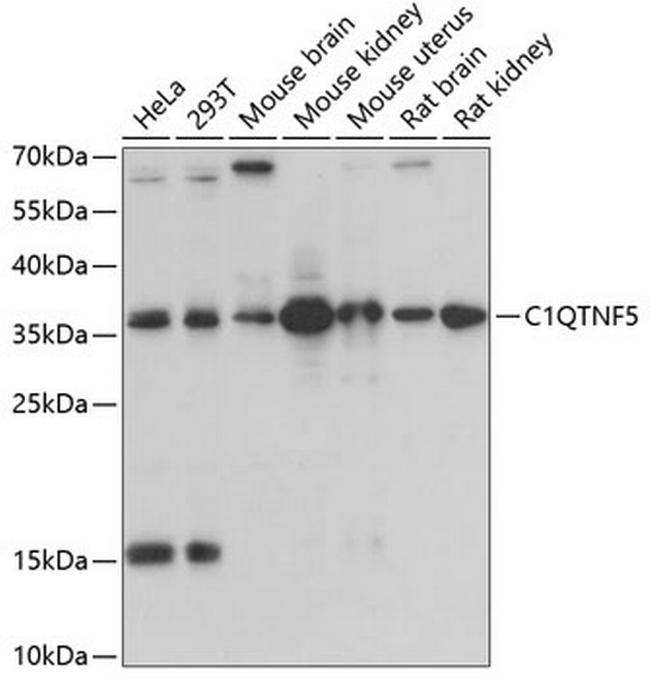 CTRP5 Antibody in Western Blot (WB)