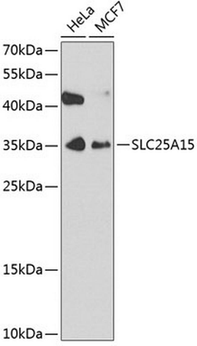 ORNT1 Antibody in Western Blot (WB)