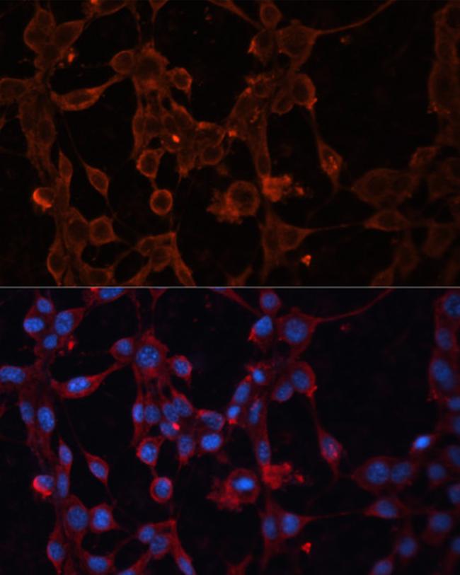 UCP4 Antibody in Immunocytochemistry (ICC/IF)