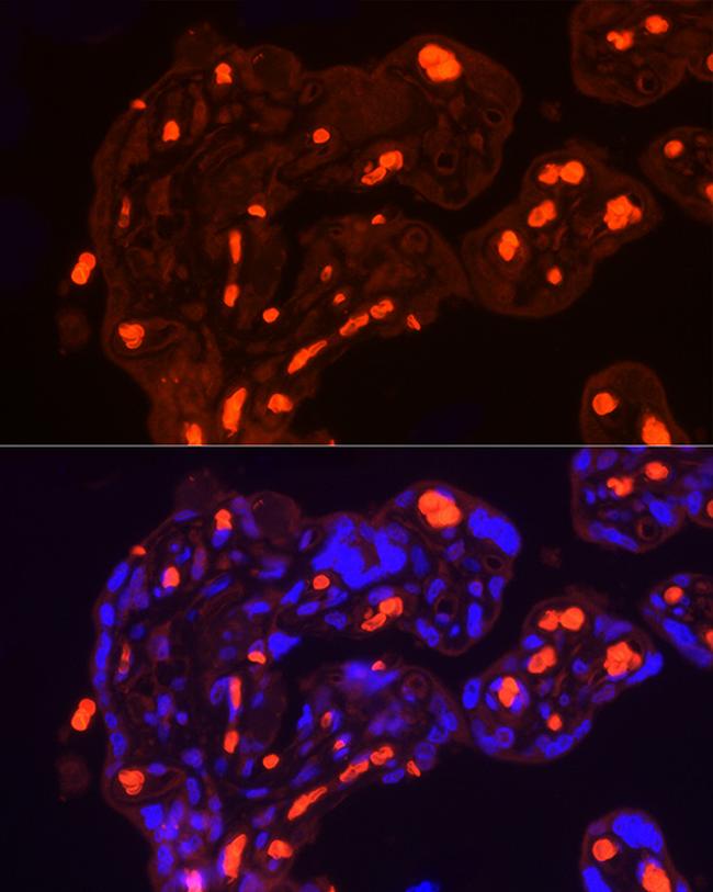 SLC4A1 Antibody in Immunohistochemistry (Paraffin) (IHC (P))