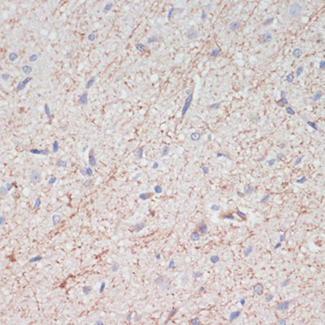 Dopamine Transporter Antibody in Immunohistochemistry (Paraffin) (IHC (P))