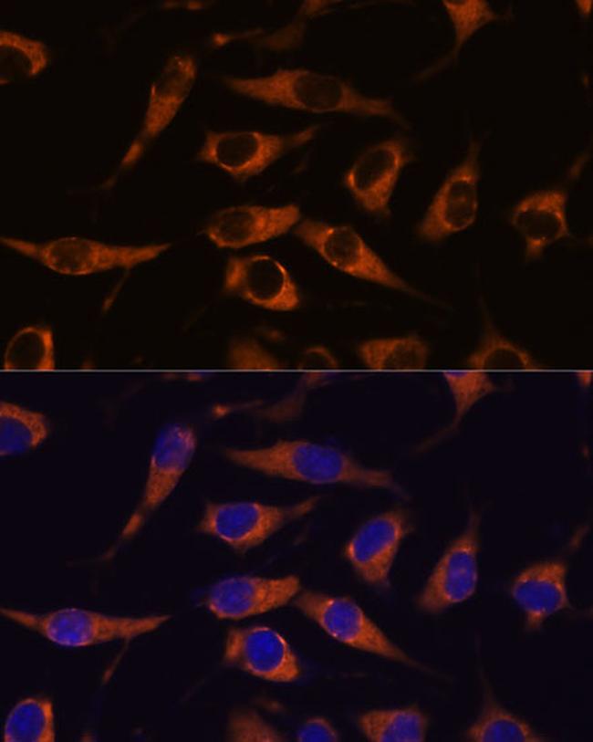 SMAP1 Antibody in Immunocytochemistry (ICC/IF)