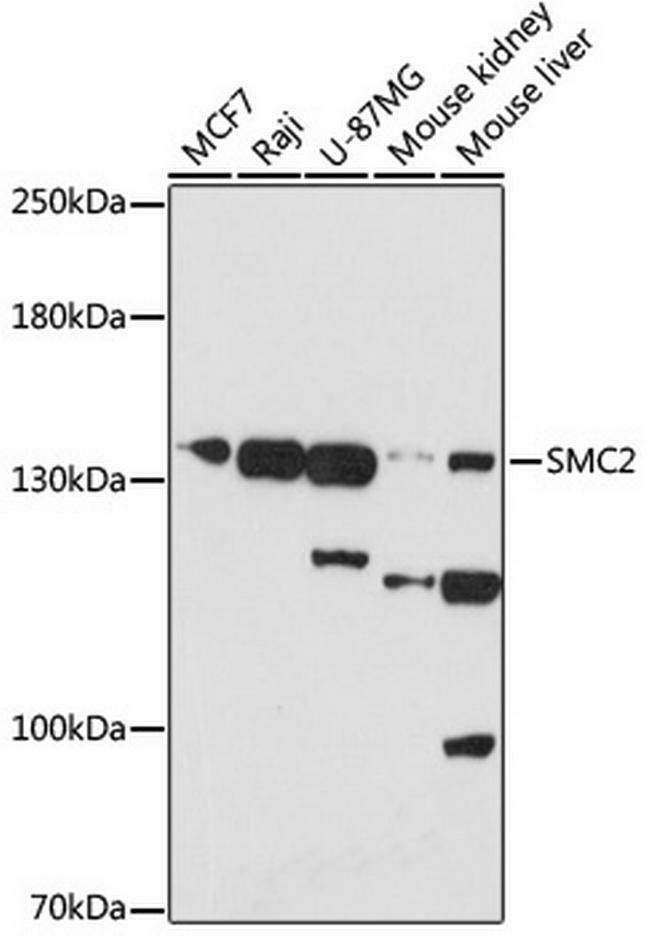 SMC2 Antibody in Western Blot (WB)