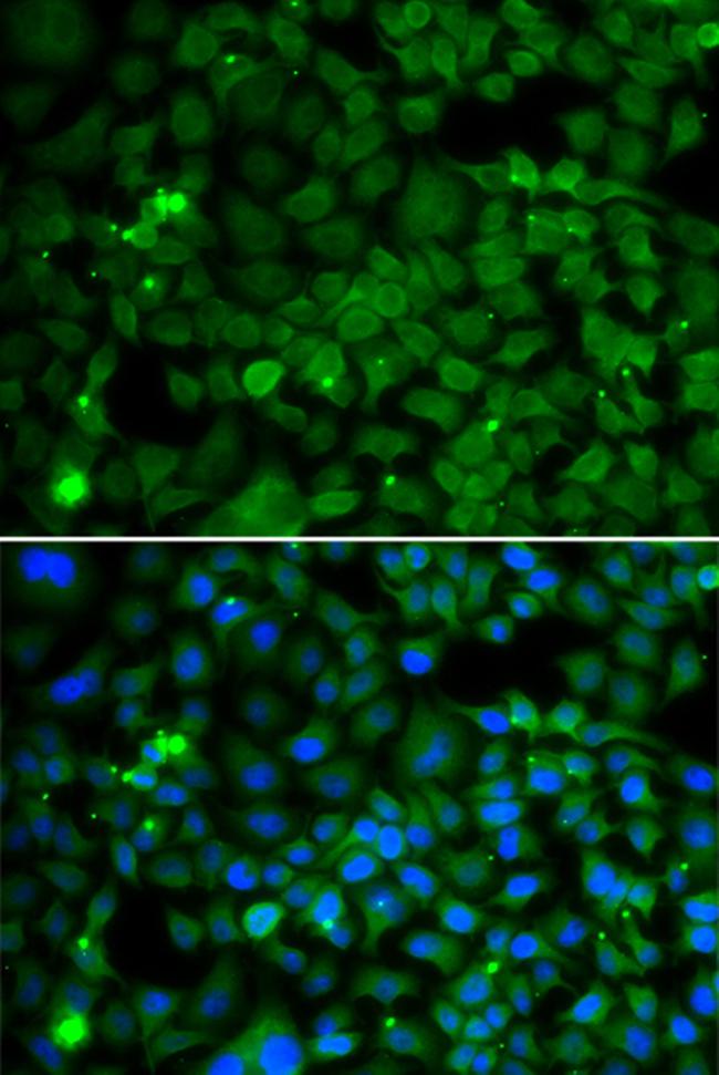 SMYD4 Antibody in Immunocytochemistry (ICC/IF)