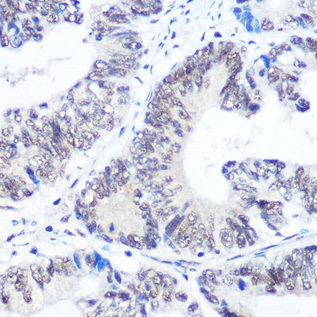 SNRPB Antibody in Immunohistochemistry (Paraffin) (IHC (P))