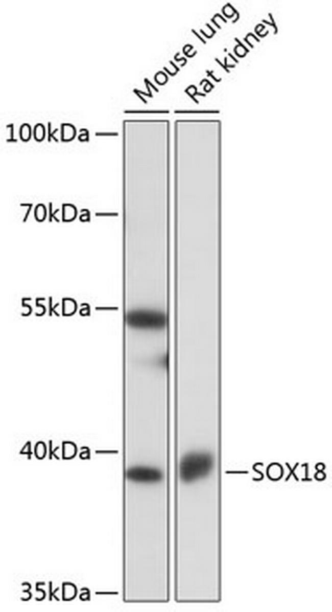 SOX18 Antibody in Western Blot (WB)