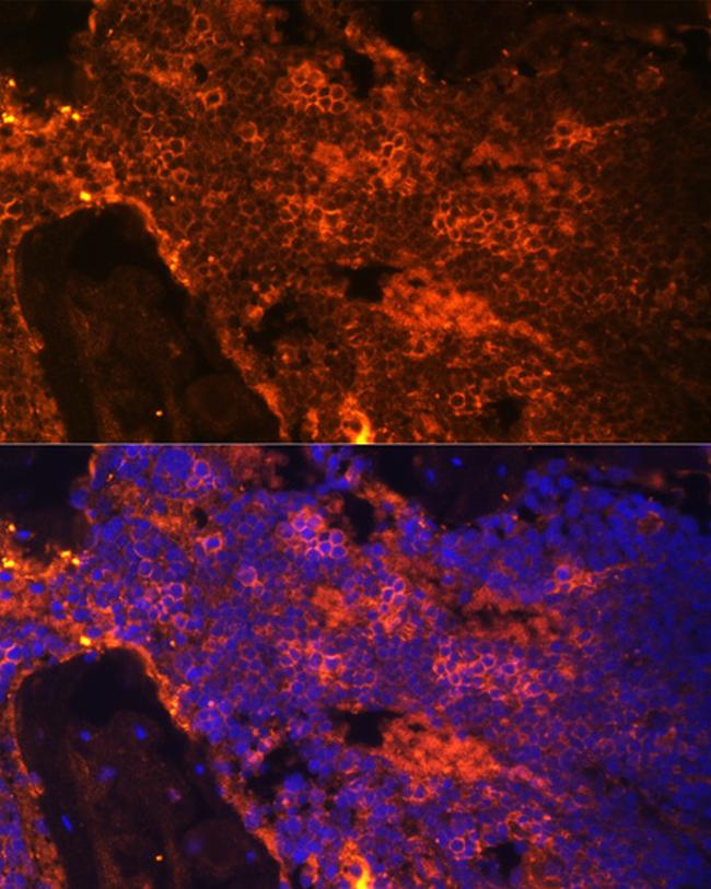 Spectrin alpha-1 Antibody in Immunocytochemistry (ICC/IF)