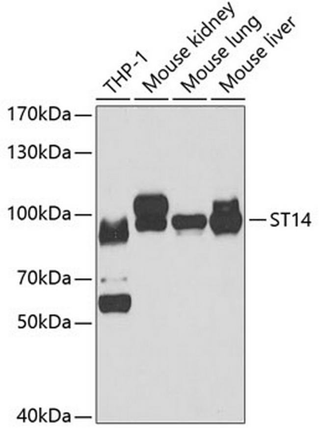 ST14 Antibody in Western Blot (WB)