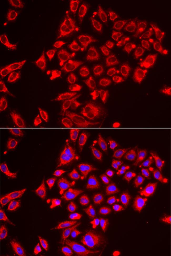 ST3GAL3 Antibody in Immunocytochemistry (ICC/IF)