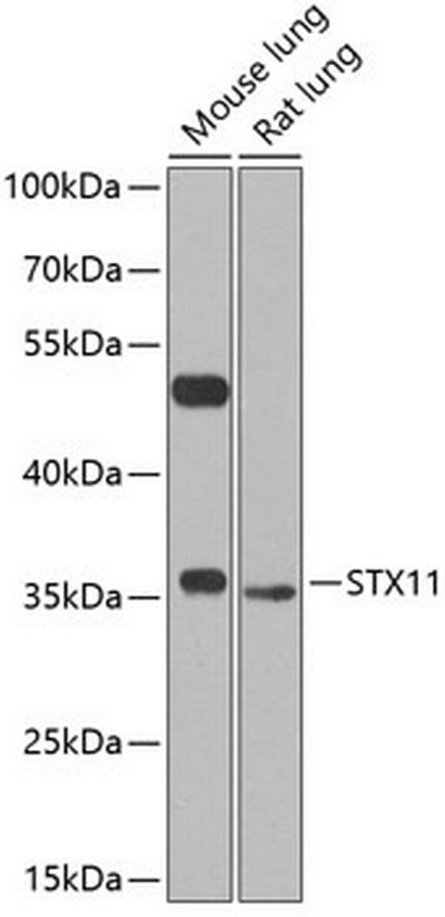 STX11 Antibody in Western Blot (WB)