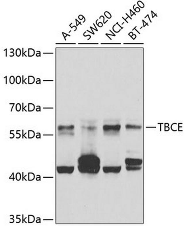 TBCE Antibody in Western Blot (WB)