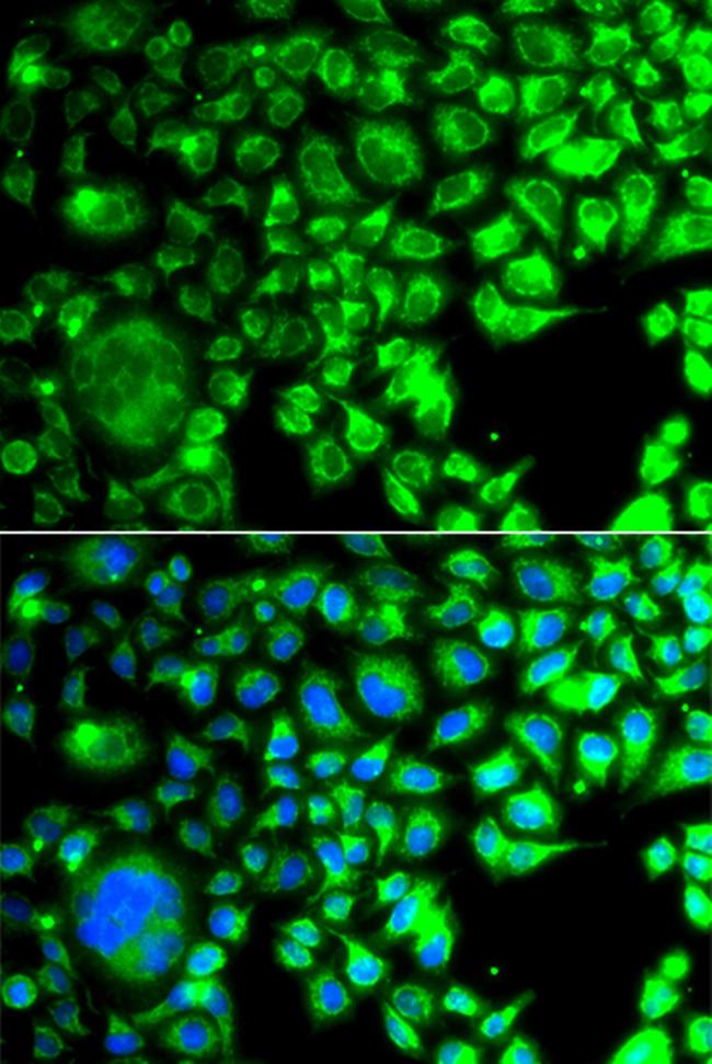 TBPL1 Antibody in Immunocytochemistry (ICC/IF)