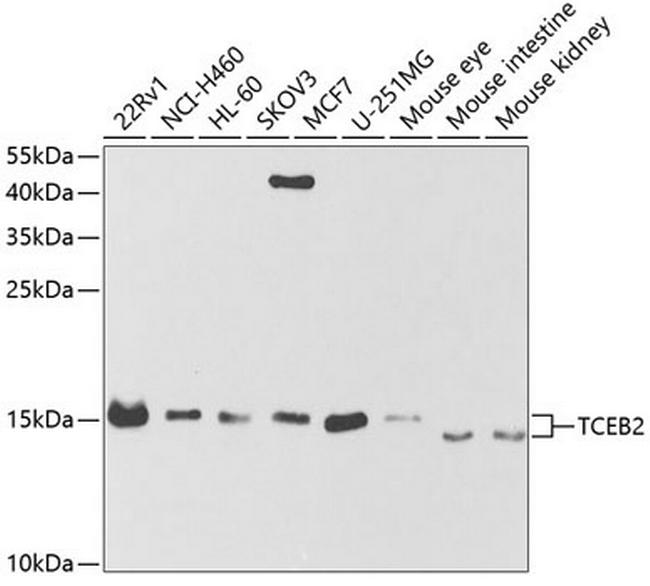 TCEB2 Antibody in Western Blot (WB)