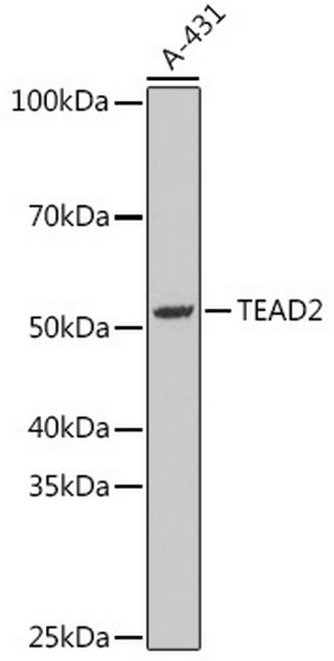 TEAD2 Antibody in Western Blot (WB)